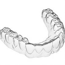 5 Lý Do Dùng  ADClearAligner khi niềng răng cần biết