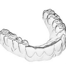 AD Clear Aligner