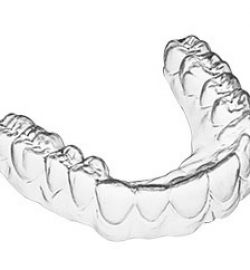 Kiến thức niềng răng